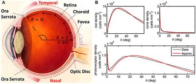 Inverse Problem Reveals Conditions for Characteristic Retinal Degeneration Patterns in Retinitis Pigmentosa Under the Trophic Factor Hypothesis